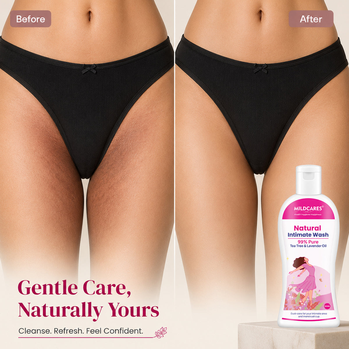 Women Intimate Care Wash : Keep Your Intimate Area Healthy And Fresh
