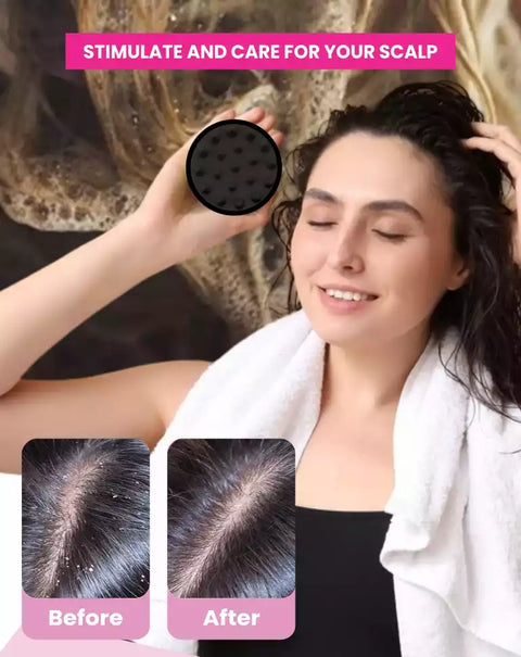 MildCares Hair Scalp Massager Brush For Hair Growth- Shampoo Scrub Hair Massager Soft Silicone Head Massager Scalp Scrubber Exfoliator,Anti-Dandruff Hair Scalp Massager Brush