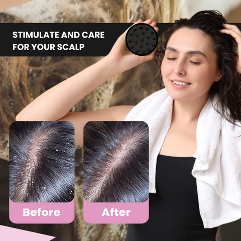 MildCares Hair Scalp Massager Brush For Hair Growth Shampoo Scrub Hair Massager Soft Silicone Head Massager Scalp Scrubber Exfoliator,Anti-Dandruff Hair Scalp Massager Brush