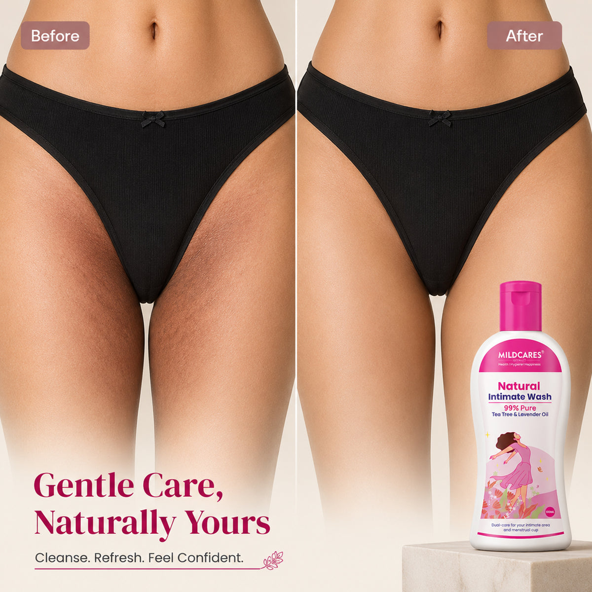 Women Intimate Care Wash : Keep Your Intimate Area Healthy And Fresh