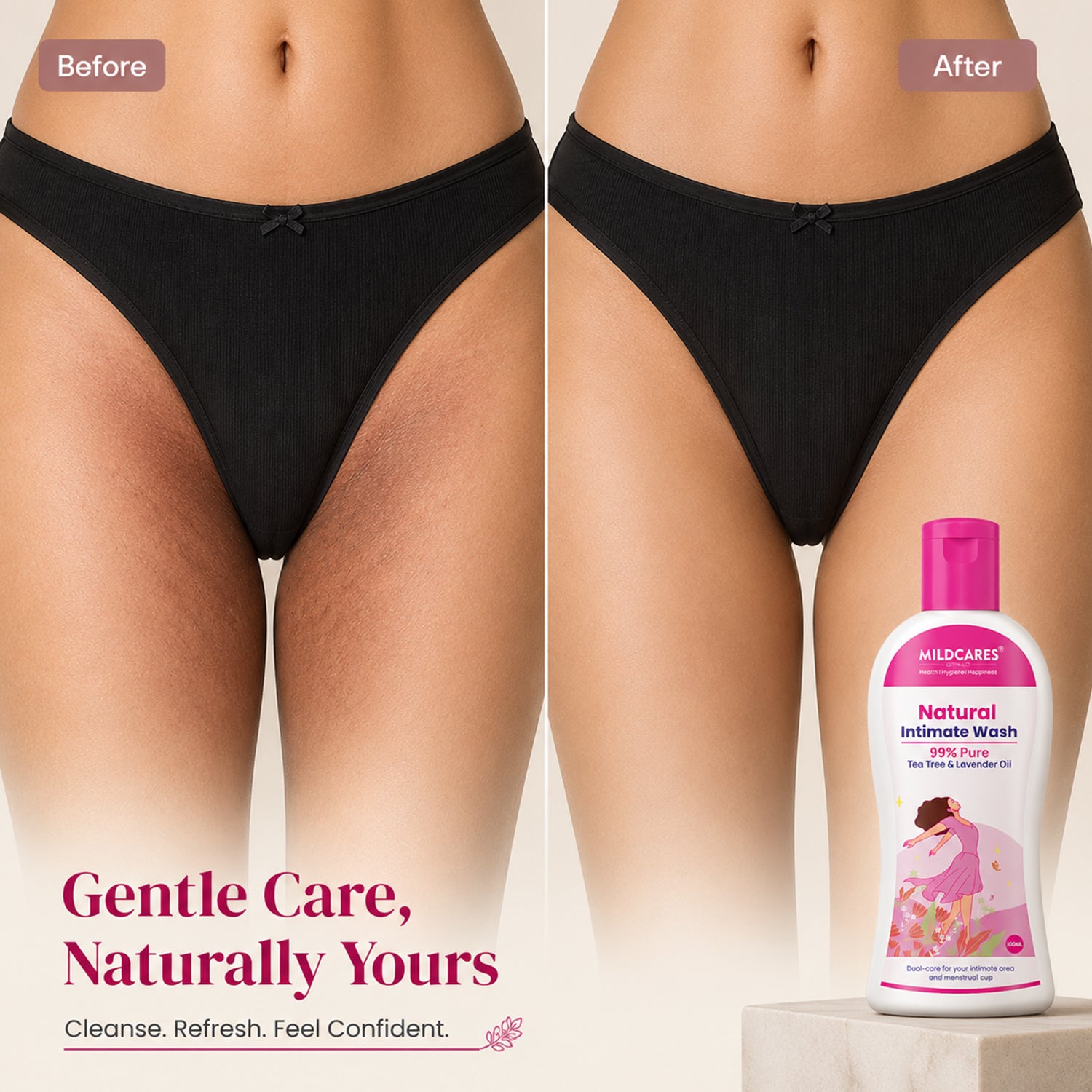 MildCares Natural Intimate Wash : Keep Your Intimate Area Healthy And Fresh (Women)